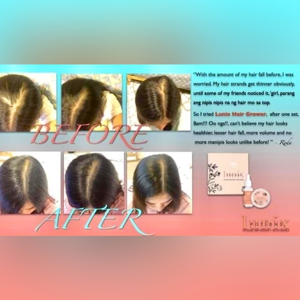 Hair Growth Treatment - Picture 8 of 10